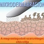 mikrodemarasion